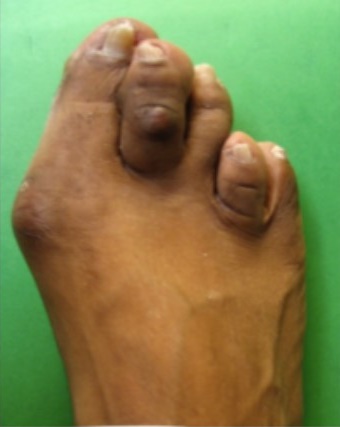 Urban Foot Care Center